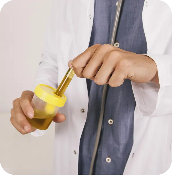 urine test